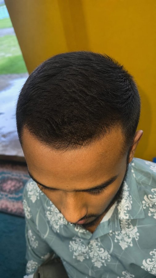 ব্যবহারের পরে